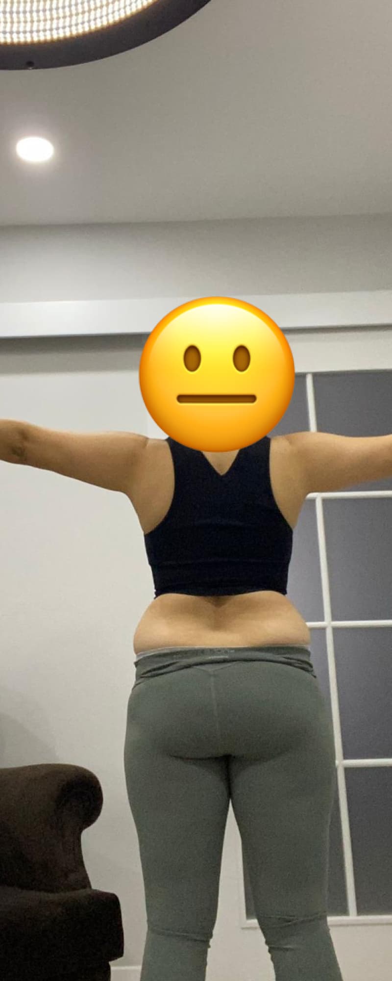 32 yaşında, bir sezeryan doğum-2